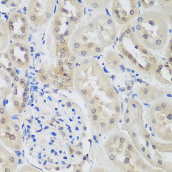 Immunohistochemistry of paraffin-embedded Rat kidney using UBE3A Polyclonal Antibody at dilution of  1:200 (40x lens).