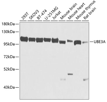 Western blot analysis of extracts of various cell lines using UBE3A Polyclonal Antibody at dilution of 1:1000.
