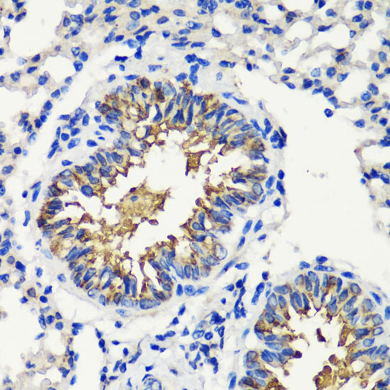 Immunohistochemistry of paraffin-embedded Mouse lung using FKBP1A Polyclonal Antibody at dilution of  1:200 (40x lens).