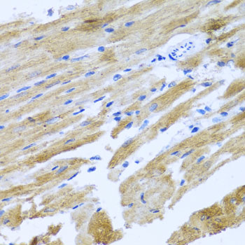 Immunohistochemistry of paraffin-embedded Rat heart using MOK Polyclonal Antibody at dilution of  1:100 (40x lens).