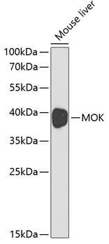 Western blot analysis of extracts of Mouse liver using MOK Polyclonal Antibody at dilution of 1:1000.