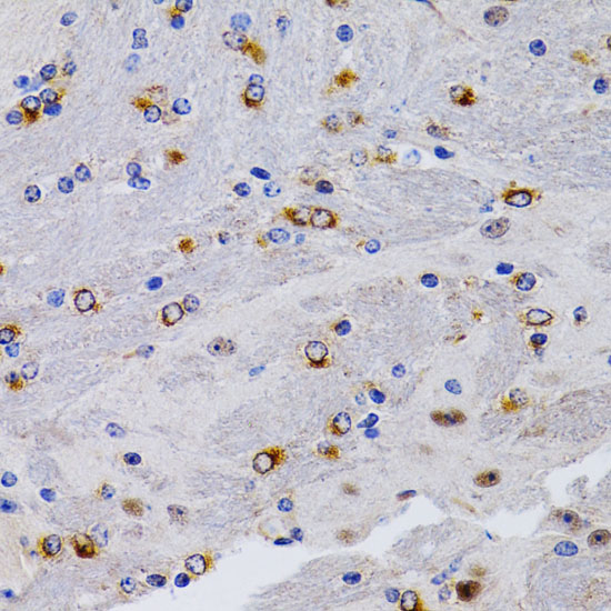 Immunohistochemistry of paraffin-embedded Mouse brain using TFF1 Polyclonal Antibody at dilution of  1:200 (40x lens).