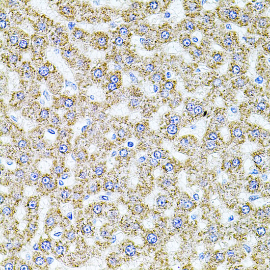 Immunohistochemistry of paraffin-embedded Rat liver using ALDH1A1 Polyclonal Antibody at dilution of  1:100 (40x lens).