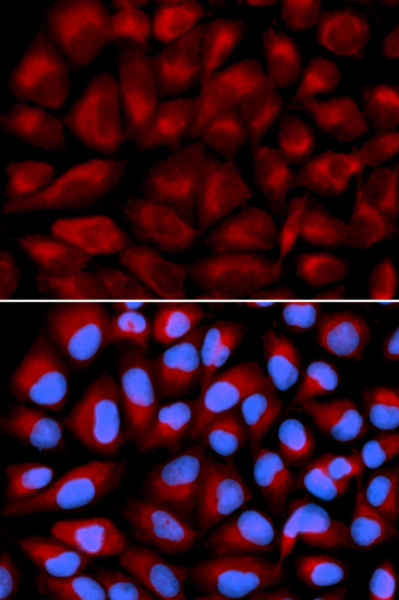 Immunofluorescence analysis of U2OS cells using FANCC Polyclonal Antibody