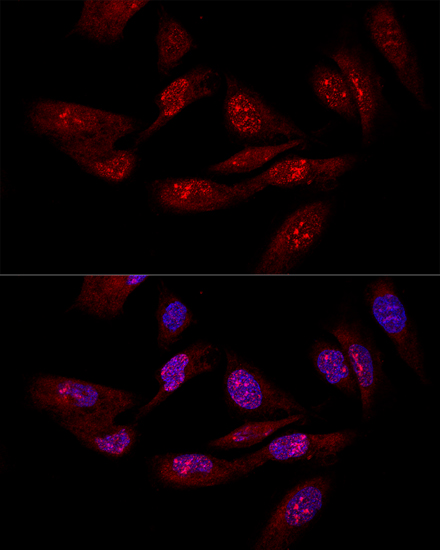 Confocal immunofluorescence analysis of U-2OS cells using EIF6 Polyclonal Antibody at dilution of  1:50. Blue: DAPI for nuclear staining.