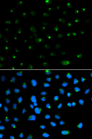 Immunofluorescence analysis of MCF-7 cells using PSAP Polyclonal Antibody