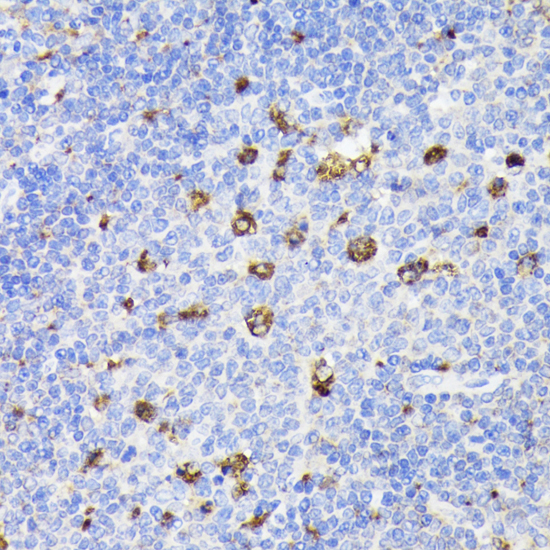 Immunohistochemistry of paraffin-embedded Rat spleen using PSAP Polyclonal Antibody at dilution of  1:200 (40x lens).