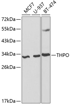 Western blot analysis of extracts of various cell lines using THPO Polyclonal Antibody at dilution of 1:1000.