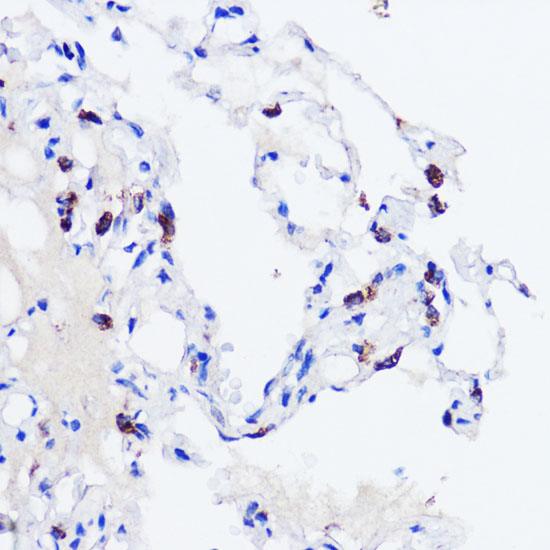 Immunohistochemistry of paraffin-embedded Human lung using SFTPC Polyclonal Antibody at dilution of  1:200 (40x lens).