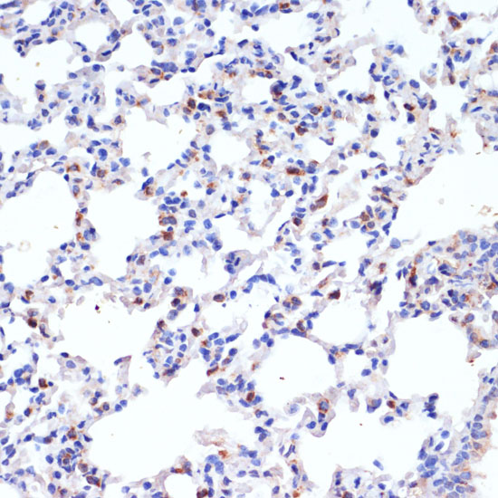 Immunohistochemistry of paraffin-embedded Rat lung using SFTPC Polyclonal Antibody at dilution of  1:200 (40x lens).
