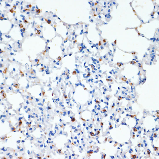Immunohistochemistry of paraffin-embedded Mouse lung using SFTPC Polyclonal Antibody at dilution of  1:200 (40x lens).