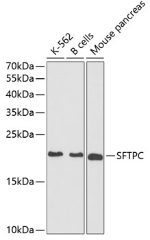 Western blot analysis of extracts of various cell lines using SFTPC Polyclonal Antibody at dilution of 1:1000.