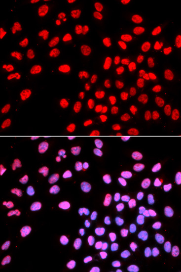 Immunofluorescence analysis of U2OS cells using IKZF1 Polyclonal Antibody