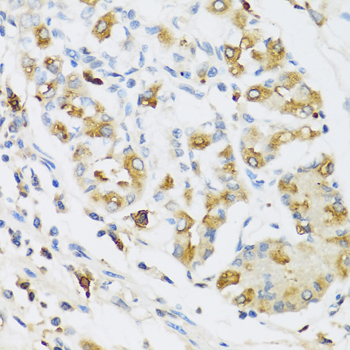 Immunohistochemistry of paraffin-embedded Human stomach using RNASE3 Polyclonal Antibody at dilution of  1:100 (40x lens).