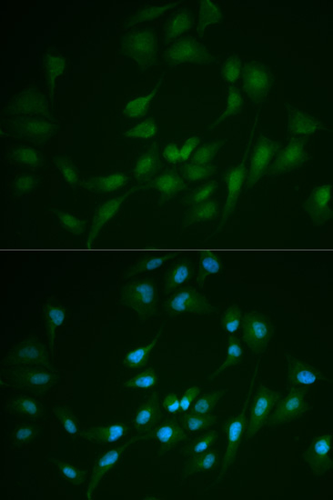 Immunofluorescence analysis of MCF-7 cells using LIG1 Polyclonal Antibody