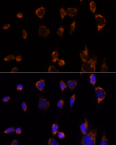 Immunofluorescence analysis of NIH-3T3 cells using PDHA1 Polyclonal Antibody at dilution of  1:100. Blue: DAPI for nuclear staining.