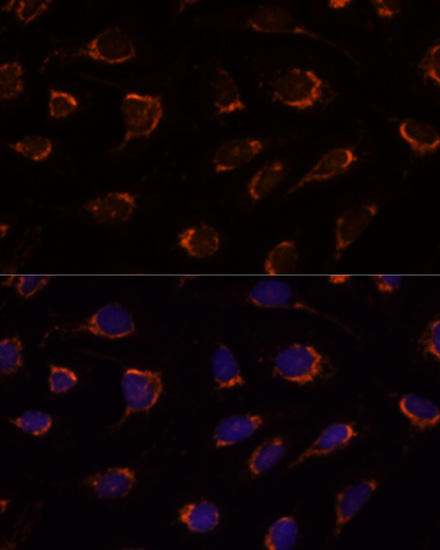 Immunofluorescence analysis of U-2 OS cells using PDHA1 Polyclonal Antibody at dilution of  1:100. Blue: DAPI for nuclear staining.