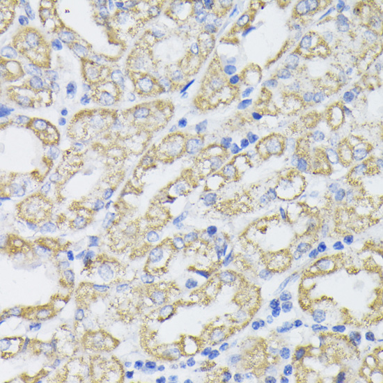 Immunohistochemistry of paraffin-embedded Human stomach using PDHA1 Polyclonal Antibody at dilution of  1:200 (40x lens).