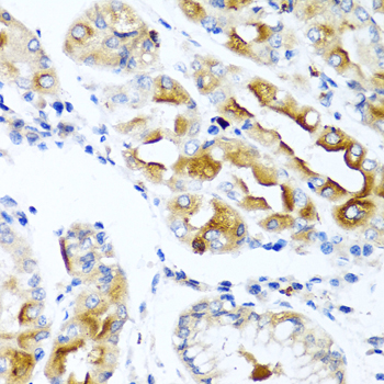 Immunohistochemistry of paraffin-embedded Human stomach using CCL21 Polyclonal Antibody at dilution of  1:100 (40x lens).