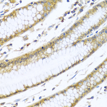 Immunohistochemistry of paraffin-embedded Human stomach using GNAI3 Polyclonal Antibody at dilution of  1:100 (40x lens).