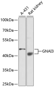 Western blot analysis of extracts of various cell lines using GNAI3 Polyclonal Antibody at dilution of 1:1000.