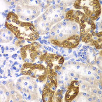 Immunohistochemistry of paraffin-embedded Rat kidney using CD151 Polyclonal Antibody at dilution of  1:200 (40x lens).