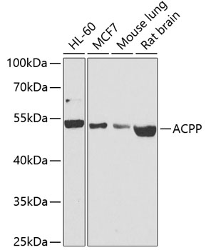 Western blot analysis of extracts of various cell lines using ACPP Polyclonal Antibody at dilution of 1:1000.