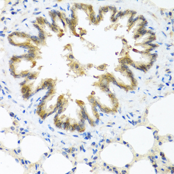 Immunohistochemistry of paraffin-embedded Rat lung using S100A7 Polyclonal Antibody at dilution of  1:100 (40x lens).