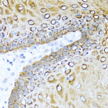 Immunohistochemistry of paraffin-embedded Human esophagus using S100A7 Polyclonal Antibody at dilution of  1:100 (40x lens).