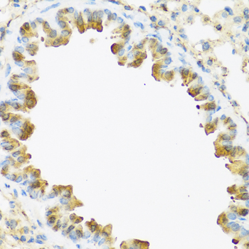 Immunohistochemistry of paraffin-embedded Mouse lung using S100A7 Polyclonal Antibody at dilution of  1:100 (40x lens).