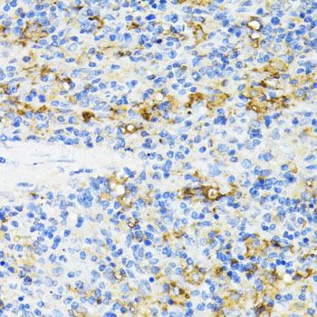 Immunohistochemistry of paraffin-embedded Rat spleen using CD27 Polyclonal Antibody at dilution of  1:100 (40x lens).