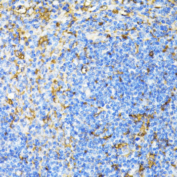 Immunohistochemistry of paraffin-embedded Mouse spleen using CD27 Polyclonal Antibody at dilution of  1:100 (40x lens).