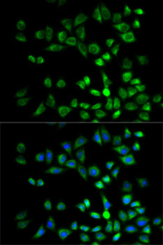 Immunofluorescence analysis of MCF7 cells using PSMD10 Polyclonal Antibody