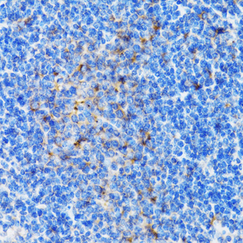 Immunohistochemistry of paraffin-embedded Mouse spleen using PSMD10 Polyclonal Antibody at dilution of  1:100 (40x lens).