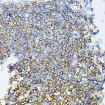 Immunohistochemistry of paraffin-embedded Rat spleen using UBE2D1 Polyclonal Antibody at dilution of  1:100 (40x lens).