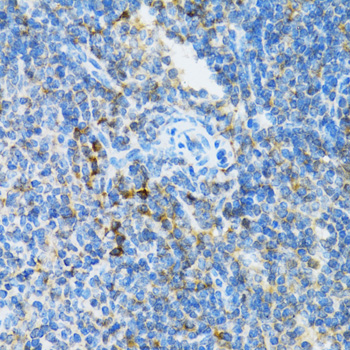 Immunohistochemistry of paraffin-embedded Mouse spleen using UBE2D1 Polyclonal Antibody at dilution of  1:100 (40x lens).