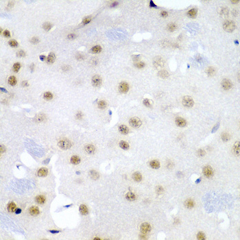 Immunohistochemistry of paraffin-embedded Mouse brain using CDC27 Polyclonal Antibody at dilution of  1:200 (40x lens).