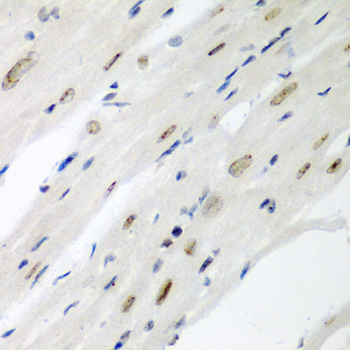 Immunohistochemistry of paraffin-embedded Mouse heart using CDC27 Polyclonal Antibody at dilution of  1:200 (40x lens).