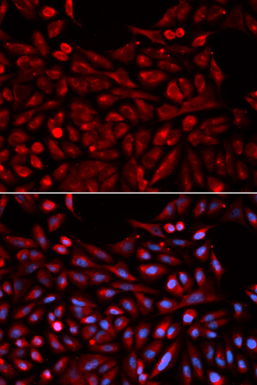 Immunofluorescence analysis of U2OS cells using NR1I3 Polyclonal Antibody