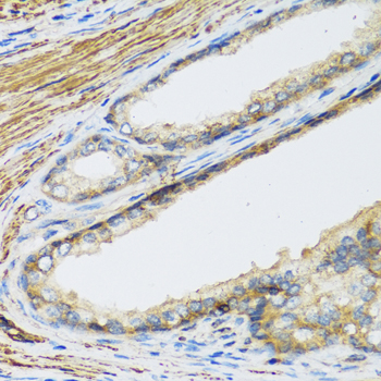 Immunohistochemistry of paraffin-embedded Human prostate using CSH1 Polyclonal Antibody at dilution of  1:100 (40x lens).