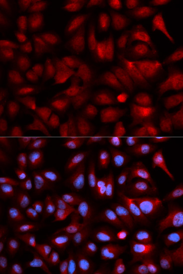 Immunofluorescence analysis of U2OS cells using PSMB5 Polyclonal Antibody