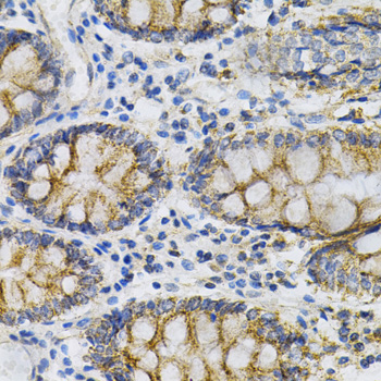 Immunohistochemistry of paraffin-embedded Human colon using PTPRA Polyclonal Antibody at dilution of  1:100 (40x lens).