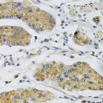 Immunohistochemistry of paraffin-embedded Human stomach using PTPRA Polyclonal Antibody at dilution of  1:100 (40x lens).