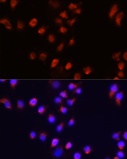 Immunofluorescence analysis of A431 cells using ACVR2A Polyclonal Antibody at dilution of  1:100 (40x lens). Blue: DAPI for nuclear staining.