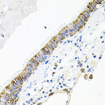Immunohistochemistry of paraffin-embedded Human lung using ACVR2A Polyclonal Antibody at dilution of  1:100 (40x lens).