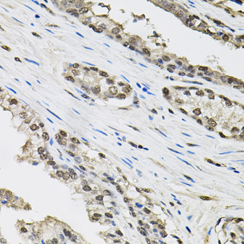 Immunohistochemistry of paraffin-embedded Human prostate using TCEB1 Polyclonal Antibody