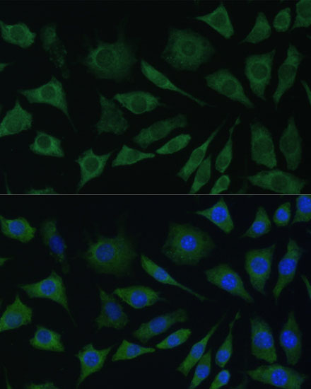 Immunofluorescence analysis of L929 cells using BMPR1B Polyclonal Antibody at dilution of  1:100. Blue: DAPI for nuclear staining.