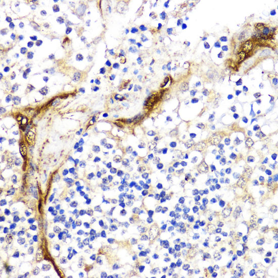 Immunohistochemistry of paraffin-embedded Human tonsil using BMPR1B Polyclonal Antibody at dilution of  1:200 (40x lens).