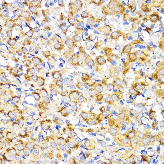 Immunohistochemistry of paraffin-embedded Rat ovary using BMPR1B Polyclonal Antibody at dilution of  1:200 (40x lens).