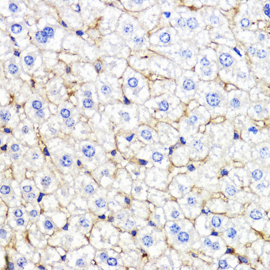Immunohistochemistry of paraffin-embedded Mouse liver using BMPR1B Polyclonal Antibody at dilution of  1:200 (40x lens).